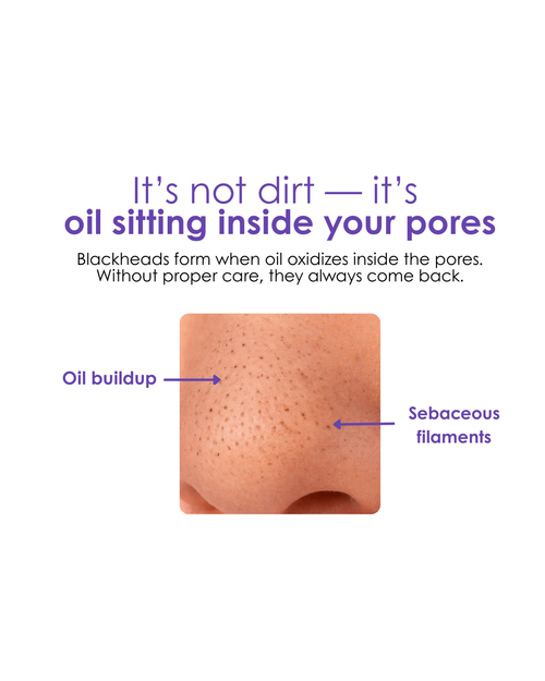 VacX Pro Pore Refiner™