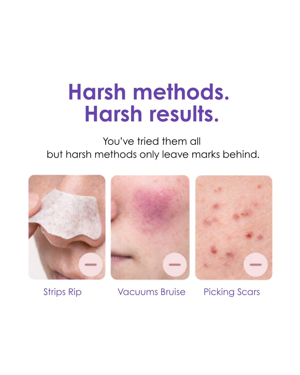 VacX Pro Pore Refiner™