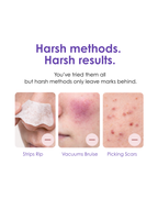 VacX Pro Pore Refiner™