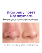 VacX Pro Pore Refiner™