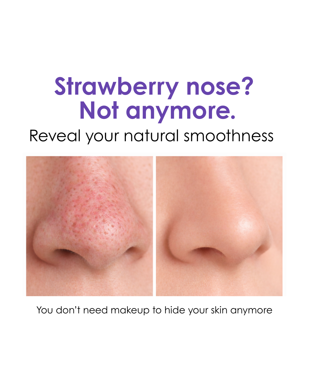 VacX Pro Pore Refiner™