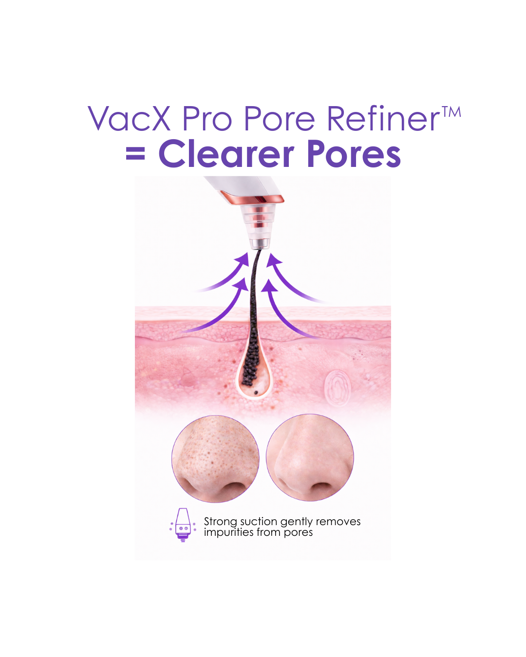 VacX Pro Pore Refiner™